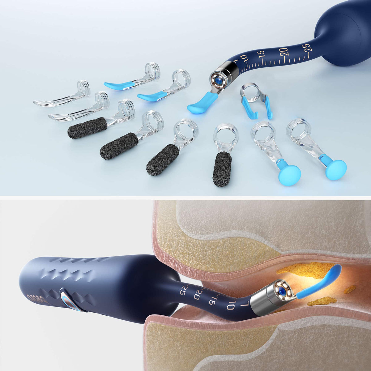 BEBIRD - Earwax Removal Kit - Blue