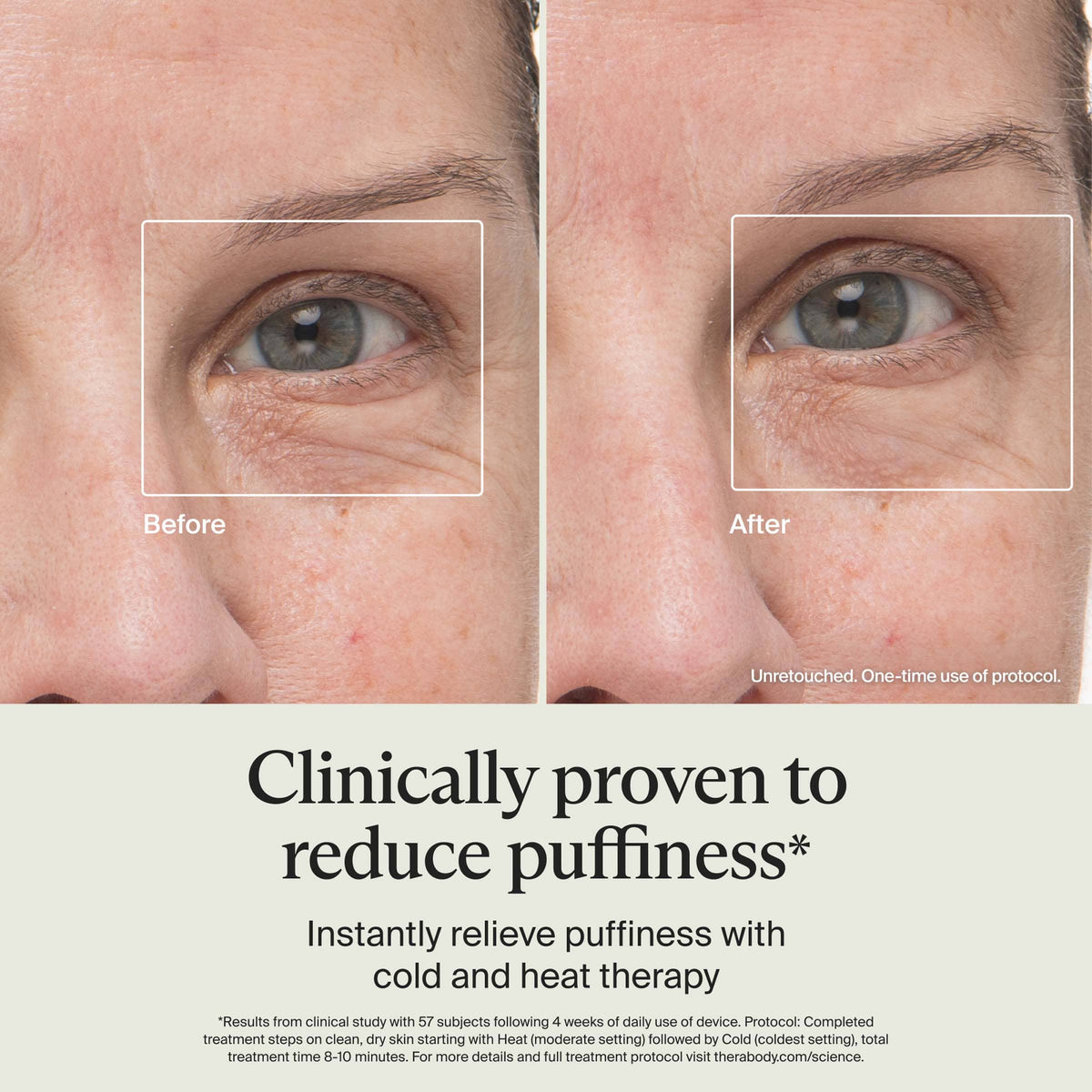 Therabody - TheraFace Depuffing Wand - Cold & Heat Facial Treatments - White